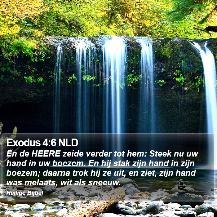 Exodus 4:6 NLD Bible Study