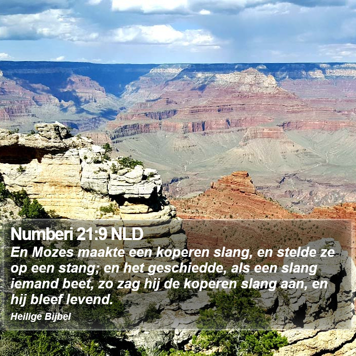 Numberi 21:9 NLD Bible Study